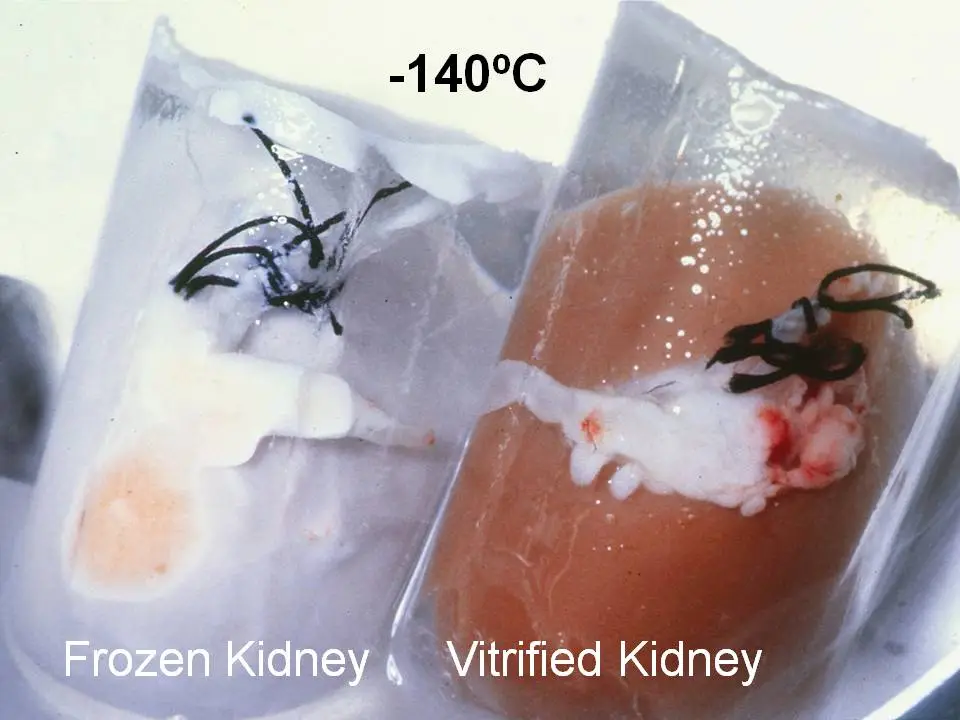 Side-by-side comparison of a frozen kidney damaged by ice and a vitrified kidney preserved reversibly at minus 140 degrees Celsius